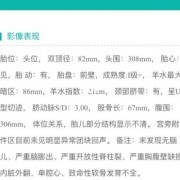 孕妈大两周是什么意思,胎儿大两周是什么原因