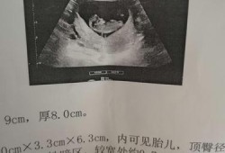 10周胎儿大小（宝宝刚出生10天最多可以喝多少毫升才正常）