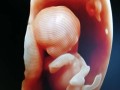 怀孕12周胎儿图片（怀孕12周胎儿图片真实）