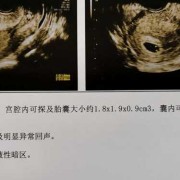 怀孕第七周胎儿图片（孕7周胚芽大小多少是正常的？怎么判断宝宝是否是健康的呢）