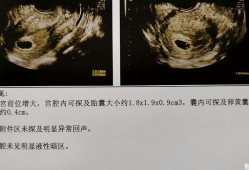 怀孕第七周胎儿图片（孕7周胚芽大小多少是正常的？怎么判断宝宝是否是健康的呢）