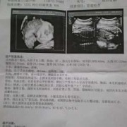 怀孕二十九周胎儿图（怀孕29周胎儿各项指标多少）