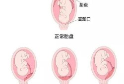 胎儿胎盘如何处理（胎盘有什么作用呢？生完孩子要留着吗）