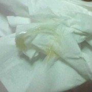 孕期分泌物黄绿色（孕期分泌物黄绿色不痒无异味）