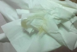 孕期分泌物黄绿色（孕期分泌物黄绿色不痒无异味）