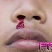 鼻子流血水，是什么原因,孕期鼻子流血是什么原因