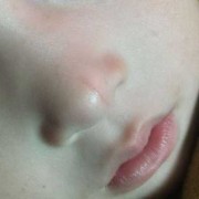胎儿鼻梁矮（宝宝口腔发热，鼻子出热气，怎么回事）