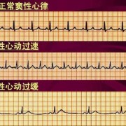 胎儿心动过缓（胎儿心动过缓的原因有哪些）