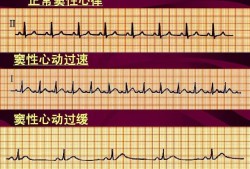 胎儿心动过缓（胎儿心动过缓的原因有哪些）