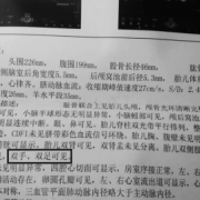 b超mi是什么意思,胎儿b超指数参考