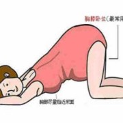 胎儿仰卧位（宝宝怎么坐起来）