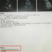 双肾皮质回声增强怎么回事,胎儿双肾皮质回声增强是怎么回事