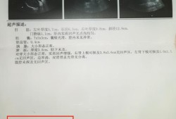 双肾皮质回声增强怎么回事,胎儿双肾皮质回声增强是怎么回事