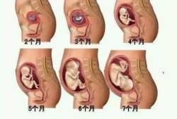 我怀孕28周了，宝宝一直动个不停属于正常的吗,胎儿动得厉害是男是女