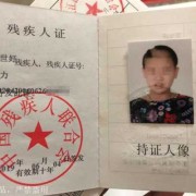 智障胎儿孕期特征（宝宝轻度弱智的表现是什么）