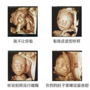 四维彩超是检查什么的,四维主要检查胎儿什么部位
