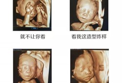 四维彩超是检查什么的,四维主要检查胎儿什么部位