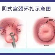 怀孕几个月胎儿开始长头发（北方小孩后脑勺留长头发有什么说法）