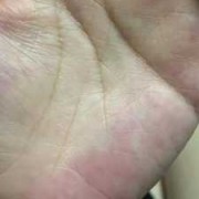 孕期的脉搏（怀孕左手脉搏跳动明显）