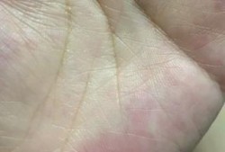 孕期的脉搏（怀孕左手脉搏跳动明显）