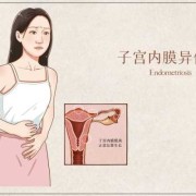 易孕期同房出血（怀孕三个月同房出血怎么办）