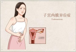 易孕期同房出血（怀孕三个月同房出血怎么办）