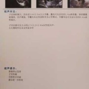 胎儿为什么会没有胎心（胎儿为什么会没有胎心胎芽）