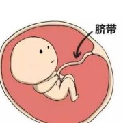 胎儿脐带短是什么原因（胎儿脐带短是什么原因造成的）