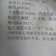 我做四维彩超结果是胎儿颈部见u型压迹这是什么意思,胎儿颈部未见明显压迹是什么意思