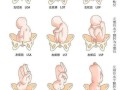 胎儿头位图片几种姿势（胎儿头位图片几种姿势图片）