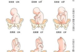 胎儿头位图片几种姿势（胎儿头位图片几种姿势图片）