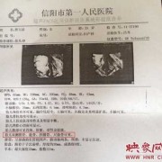 生下小孩后发现小孩是残疾，请问能不要吗,胎儿残疾能检查出来吗