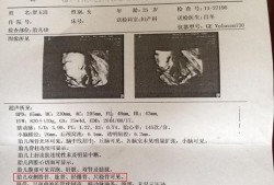 生下小孩后发现小孩是残疾，请问能不要吗,胎儿残疾能检查出来吗