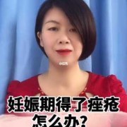 孕期痤疮（孕期痤疮严重该怎么办）