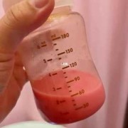 孕期乳汁有血（孕期乳汁有血怎么回事）