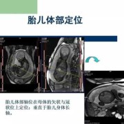 胎儿mr检查（MR成像技术分类）