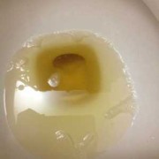 孕期尿特多（怀孕38周，一直感觉尿涨的感觉是怎么回事）