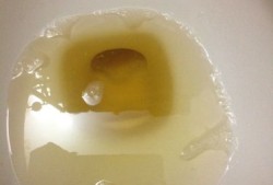 孕期尿特多（怀孕38周，一直感觉尿涨的感觉是怎么回事）