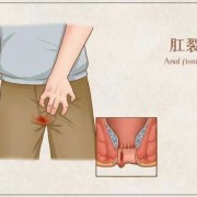 孕期肛门痛（孕期肛门痛什么原因引起的）