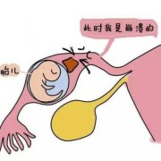 宫腔内出血什么原因,孕期宫内出血的原因有哪些