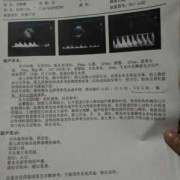 胎儿心跳180（胎儿心跳180正常吗）