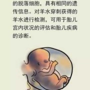 胎儿腹部肠管回声增强（怀孕7个月胎儿肠管回声强，羊水多怎么办）