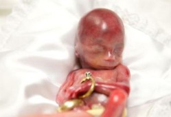 19周的胎宝宝有多少毫米,怀孕19周胎儿高清图片