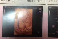 5个半月胎儿图片（五个月宝宝要吃维生素d吗）