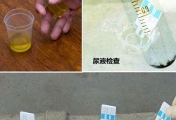 孕期验尿需要空腹吗（做尿液检测需要空腹吗）