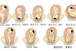胎儿正常胎位（胎儿什么时候定胎位）