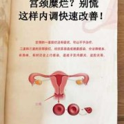 孕期宫颈糜烂怎么治疗（子宫颈糜烂怎么治疗）