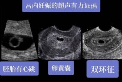 胎囊与胎儿（孕囊回声是什么意思）