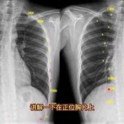 胸片对胎儿的影响（产后可以拍胸片吗）