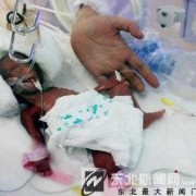 怀孕26周胎儿图片（26周孩子有多少斤）